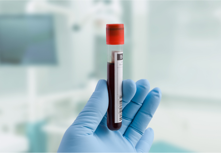 DUI Consultation Plainsboro, NJ DUI Consultation Plainsboro, NJ